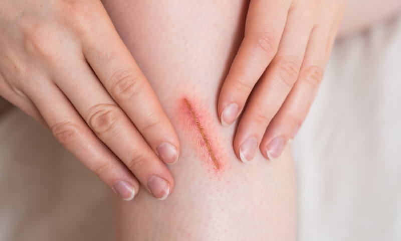 Pain management