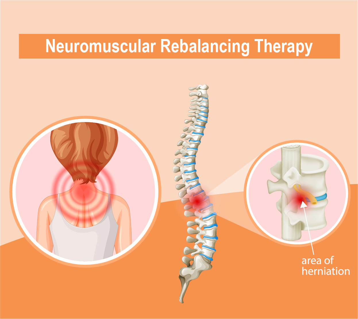 Neuromuscular Rebalancing Therapy