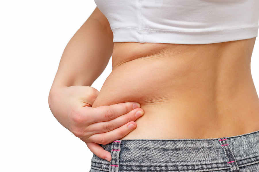 pcos belly shape