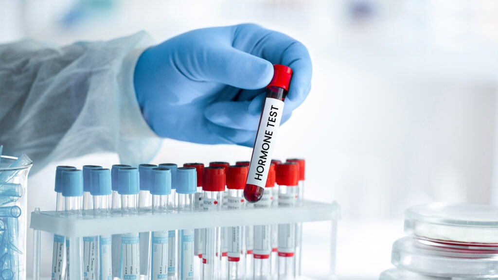 Hormone Testing
