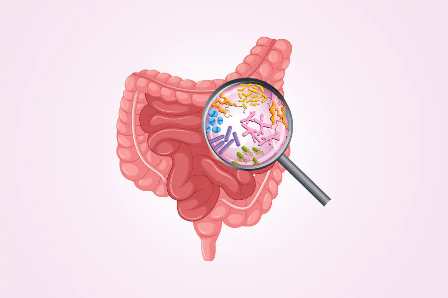 glutathione sibo Die-Off Vs. Food Intolerance: How To Tell The Difference SC_Clogged Pores 31 P NMR spectra Color:Pink Silk