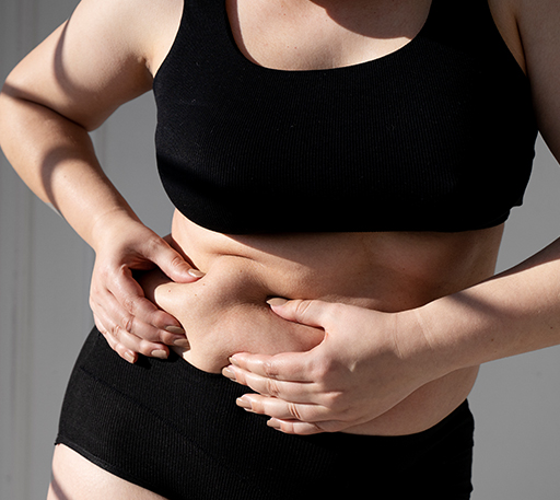 PCOS Belly