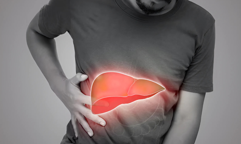 Fatty Liver