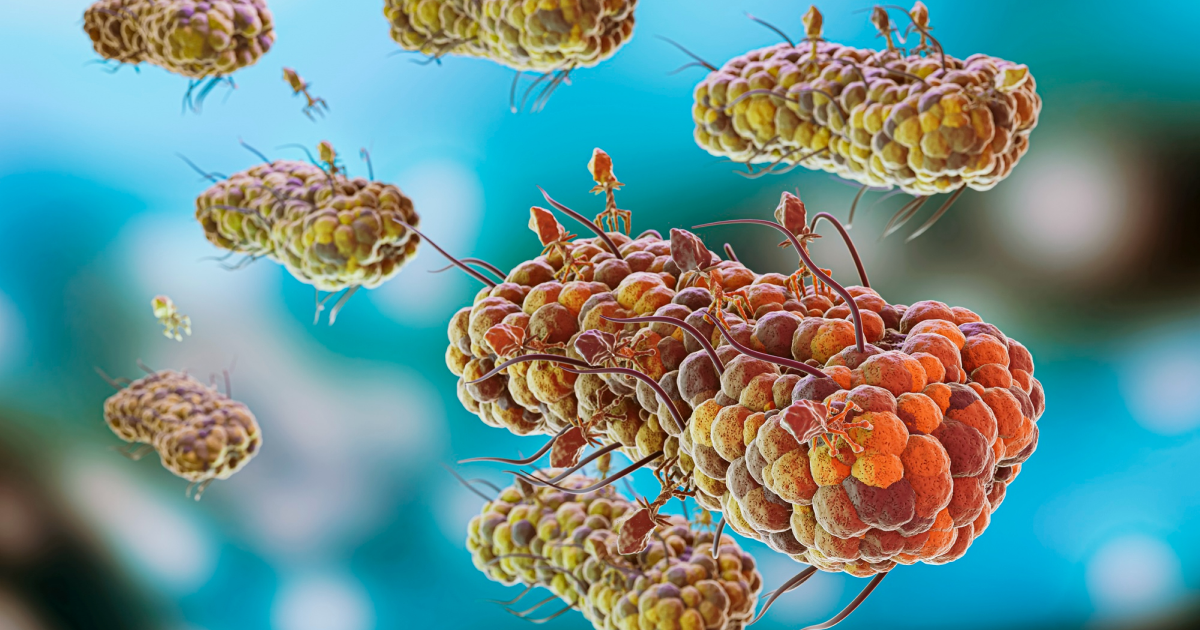 How is SIBO Diagnosed